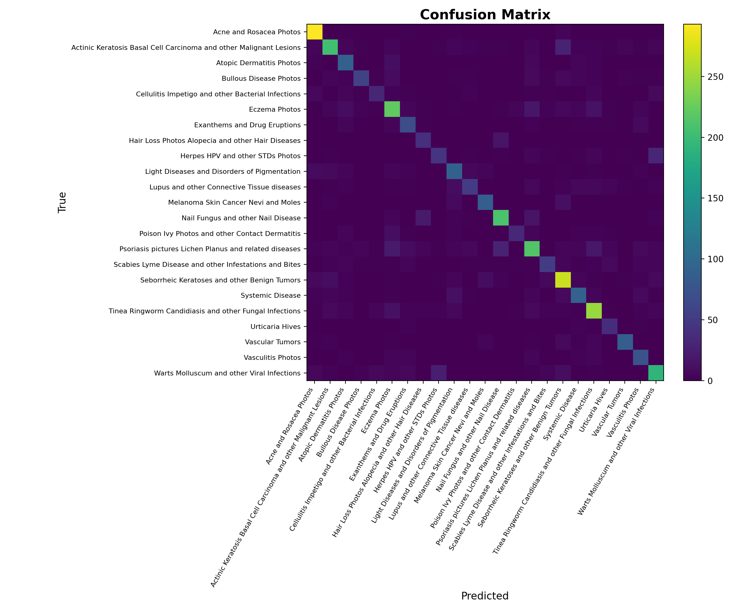 Confusion matrix